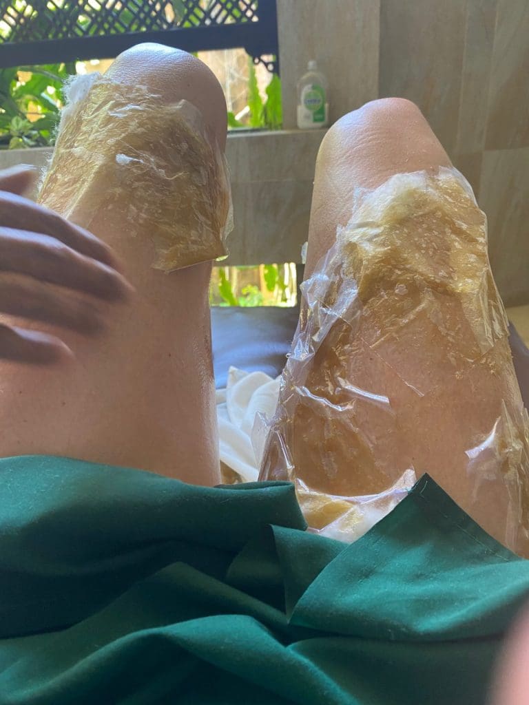 women legs with oil patches being applied